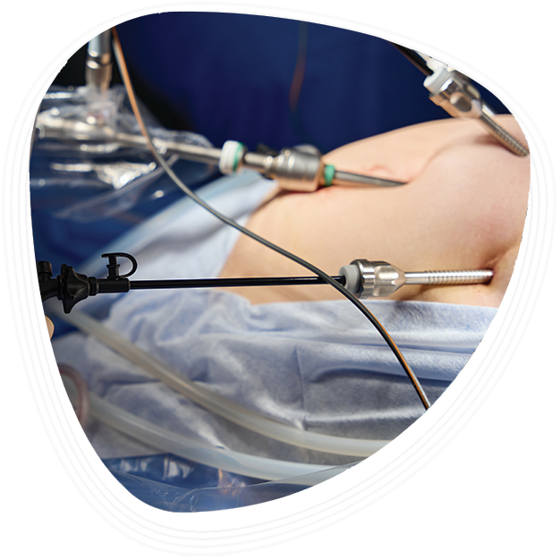 Rajiv Gandhi Cancer Hospital Hospital for Bariatric Surgery